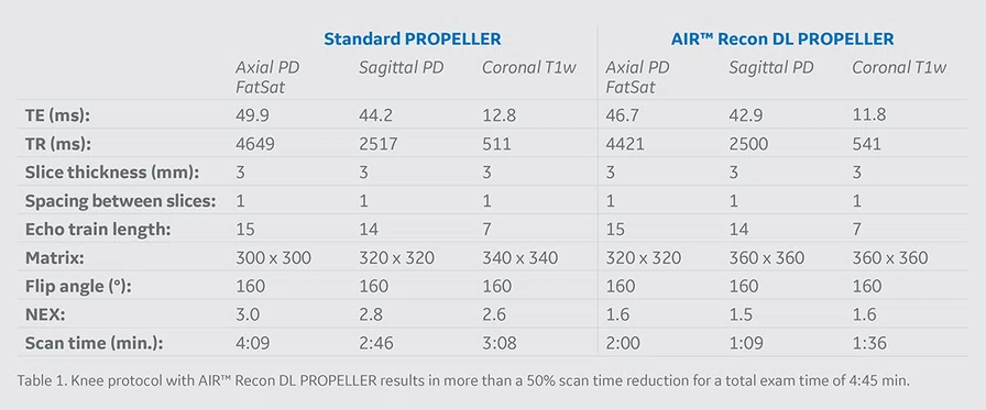 Table 1 - Std Propeller vs AIR Recon DL Propeller.