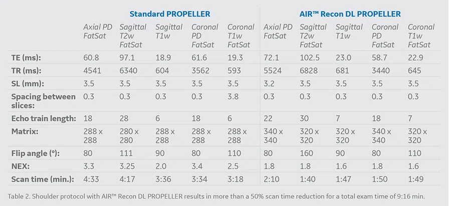 Table 2 - Std Propeller vs AIR Recon DL Propeller.