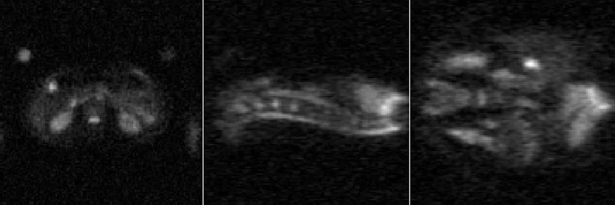 IS_Multinuclear Imaging Fig3.jpg