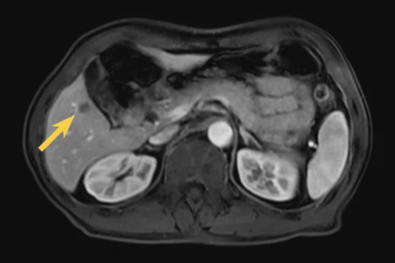 CS_PET:MR breast and liver_Fig2 C.jpg