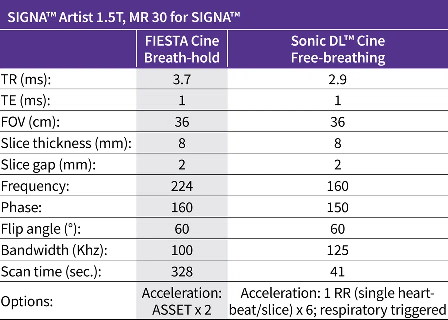 SIGNA_Table_1_Artist1.5_MR30_Chart.jpg