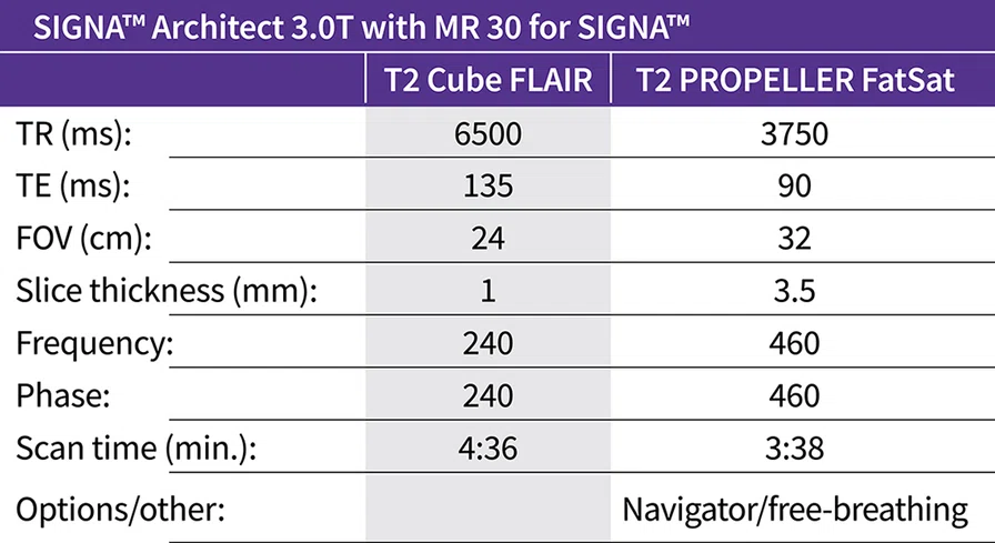 SIGNA_Architect3.0TwithMR30_Chart.jpg