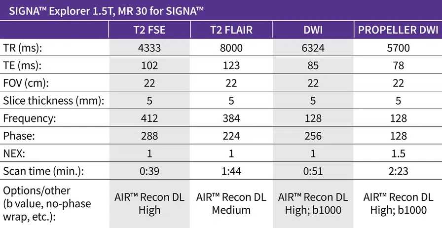 SIGNA_Explorer1.5T_MR30_Chart.jpg