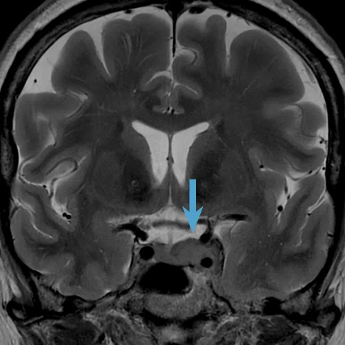 CS_Quironsalud_Fig_1A.jpg