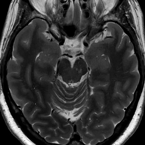 CS_Quironsalud_Fig_1C.jpg