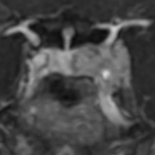 CS_Quironsalud_Fig_2C.jpg