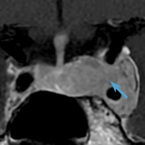 CS_Quironsalud_Fig_2F.jpg