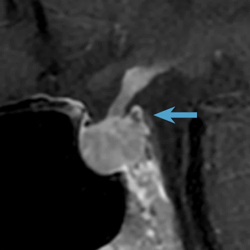 CS_Quironsalud_Fig_2H.jpg