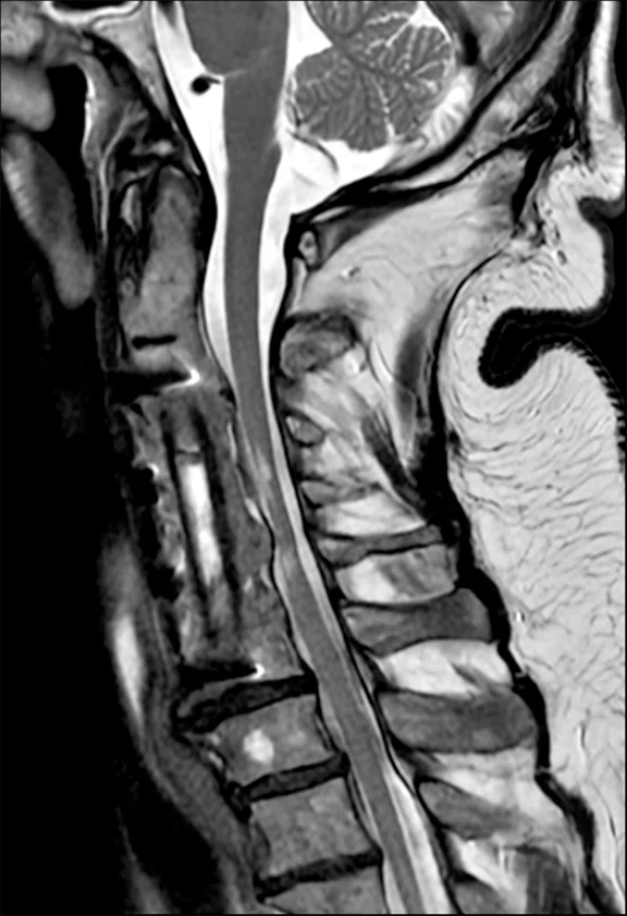 IP_AD and neuro care pathway_image3 Fig 1A.jpg