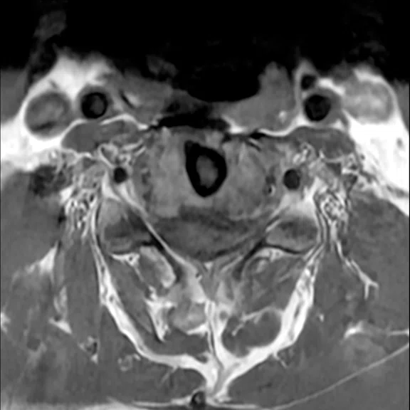 IP_AD and neuro care pathway_image4 Fig 1B.jpg