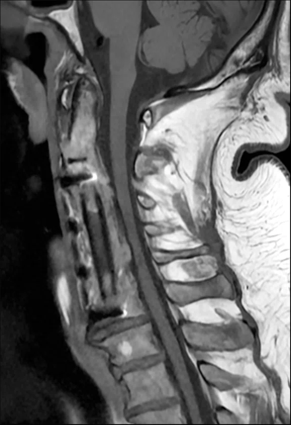 IP_AD and neuro care pathway_image6 Fig 1D.jpg