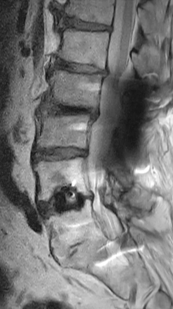 IP_AD and neuro care pathway_image8 Fig 2A.jpg