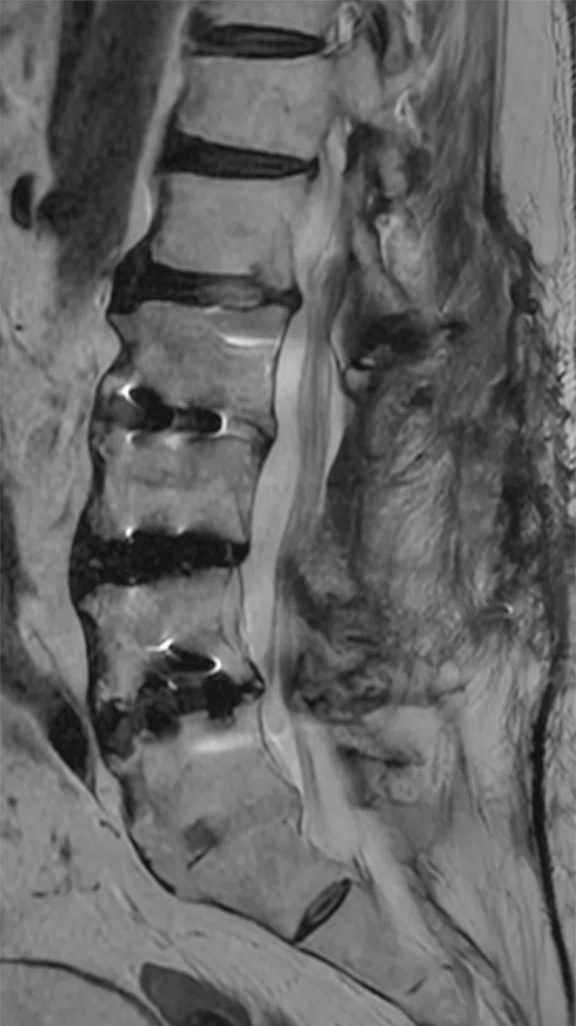 IP_AD and neuro care pathway_image7 Fig 2B.jpg