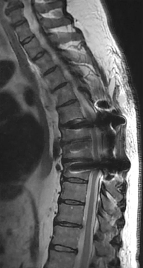 IP_AD and neuro care pathway_image10 Fig 3A.jpg