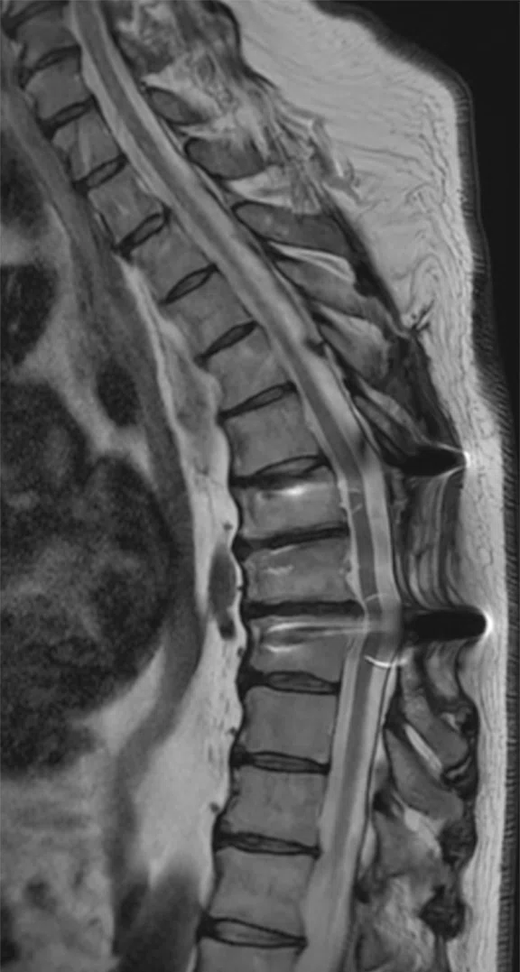 IP_AD and neuro care pathway_image9 Fig 3B.jpg