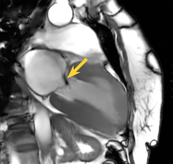 IP_15 min cardiac exam_image11 FIG 2A.jpg