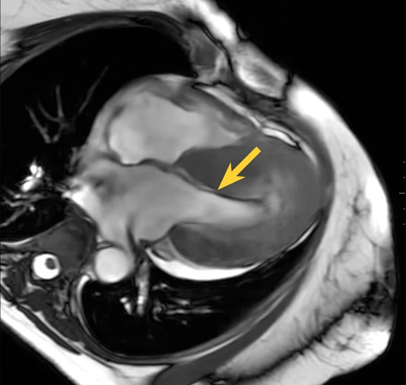 IP_15 min cardiac exam_image12 FIG 2C.jpg