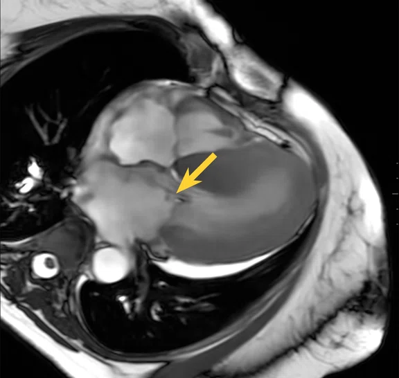 IP_15 min cardiac exam_image13 FIG 2D.jpg