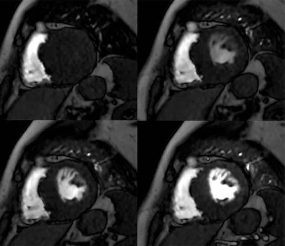 IP_15 min cardiac exam_image15 FIG 2E.jpg