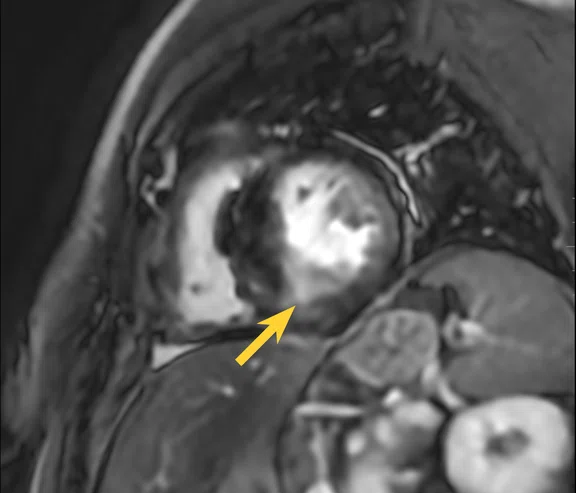 IP_15 min cardiac exam_image14 FIG 2F.jpg