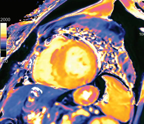 IP_15 min cardiac exam_image17 FIG 2G.jpg