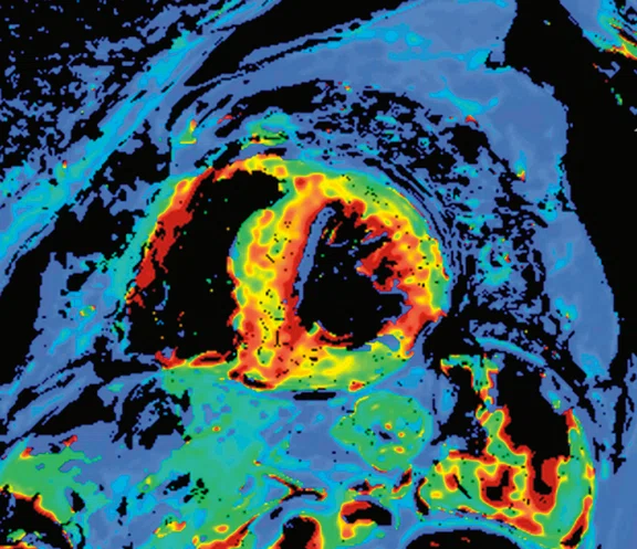 IP_15 min cardiac exam_image16 FIG 2H.jpg