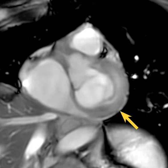 IP_15 min cardiac exam_image22 FIG 3A.jpg