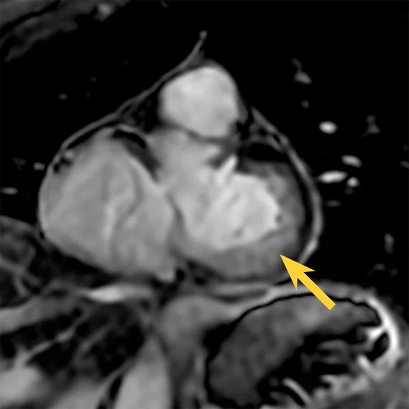 IP_15 min cardiac exam_image25 FIG 3B.jpg