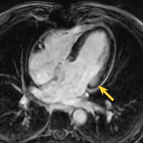 IP_15 min cardiac exam_image24 FIG 3C.jpg