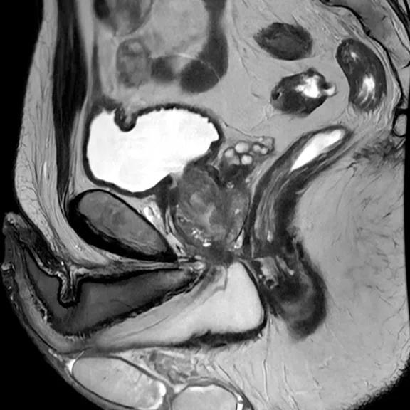 IP_Voyager Prostate (RMI)_image5 Fig 1A .jpg