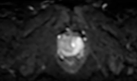 IP_Voyager Prostate (RMI)_image11 Fig 2C.jpg