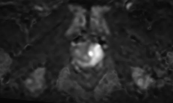 IP_Voyager Prostate (RMI)_image12 Fig 2E.jpg