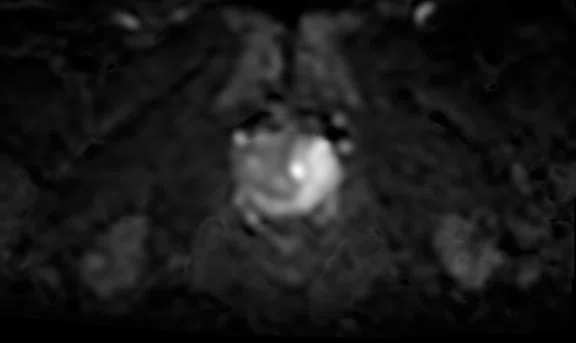 IP_Voyager Prostate (RMI)_image13 Fig 2D.jpg