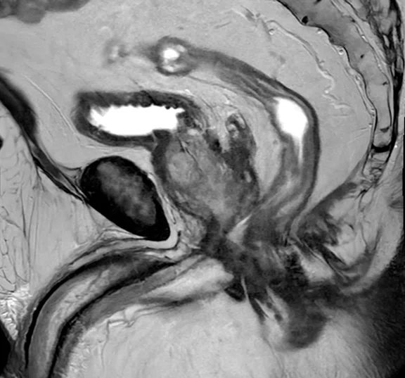 IP_Voyager Prostate (RMI)_image17 Fig 3A.jpg