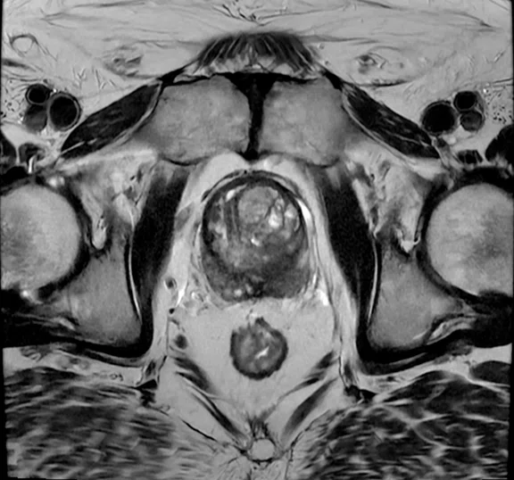 IP_Voyager Prostate (RMI)_image19 Fig 3C.jpg