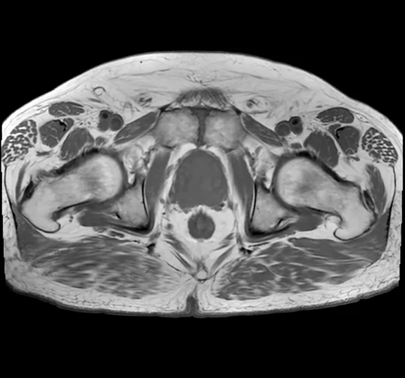 IP_Voyager Prostate (RMI)_image16 Fig 3E.jpg