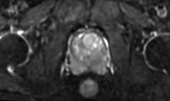 IP_Voyager Prostate (RMI)_image21 Fig 4A.jpg