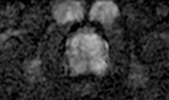 IP_Voyager Prostate (RMI)_image22 Fig 4B.jpg