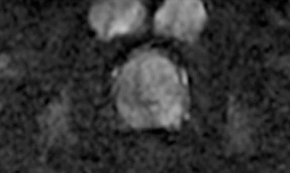 IP_Voyager Prostate (RMI)_image23 Fig 4C.jpg