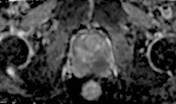 IP_Voyager Prostate (RMI)_image26 FIG 4F.jpg