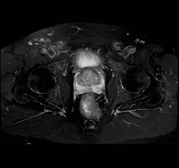 IP_Voyager Prostate (RMI)_image27 FIG 5D.jpg