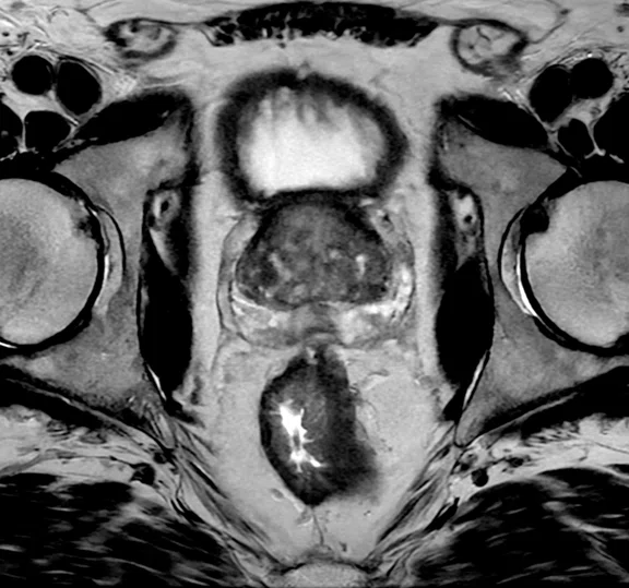 IP_Voyager Prostate (RMI)_image32 FIG 5C.jpg