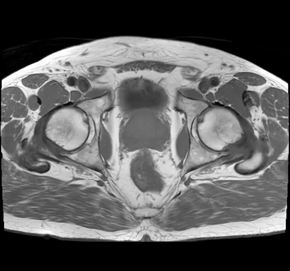 IP_Voyager Prostate (RMI)_image28 FIG 5E.jpg