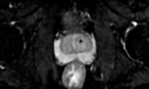 IP_Voyager Prostate (RMI)_image35 FIG 6A.jpg