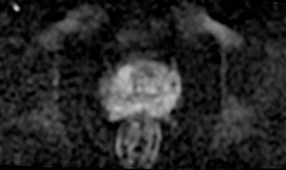 IP_Voyager Prostate (RMI)_image33 FIG 6C.jpg