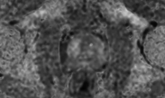 IP_Voyager Prostate (RMI)_image36 FIG 6E.jpg
