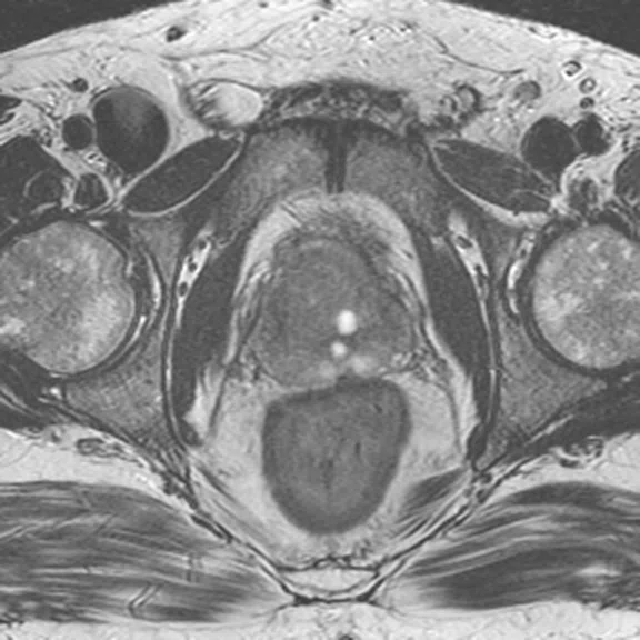 IP_PET-MRI_image18 Fig 1A.jpg