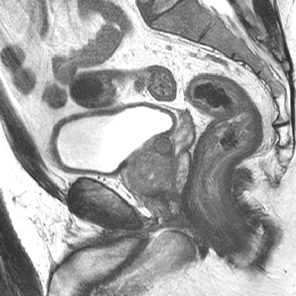 IP_PET-MRI_image19 Fig 1E.jpg