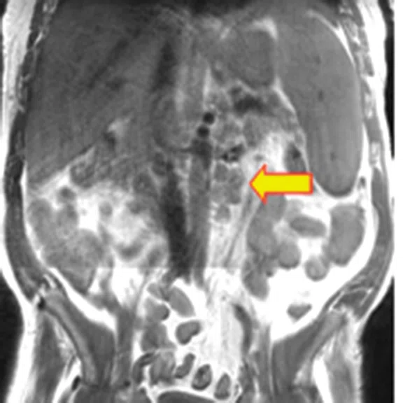 IP_PET-MRI_image27 Fig 1I.jpg