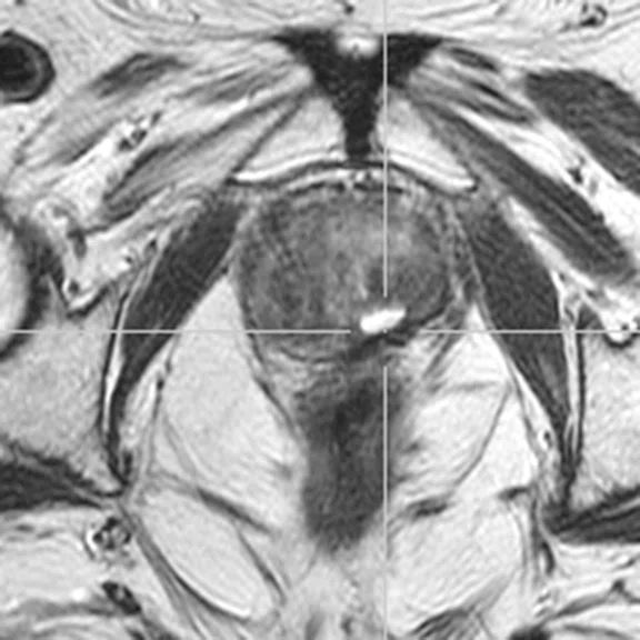 IP_PET-MRI_image41 Fig 2A.jpg